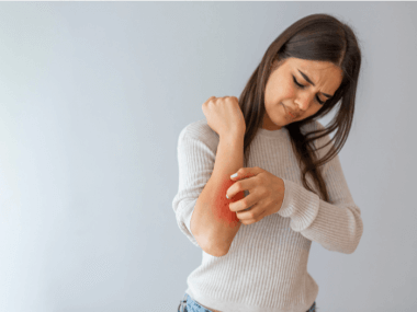 itchy arm