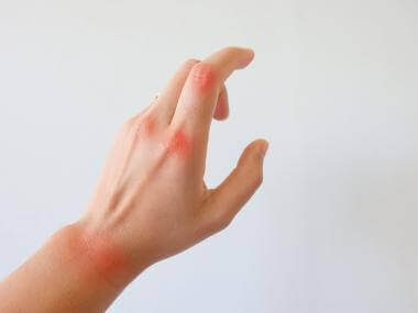 Soothe Your Arthritis with These 9 Tricks