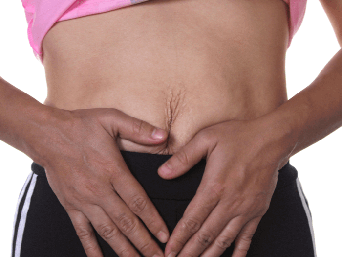 Can You Tighten Loose Skin After Weight Loss Get Fit Guy