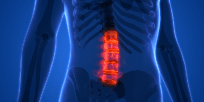 image of a spinal cord in pain due to spinal stenosis