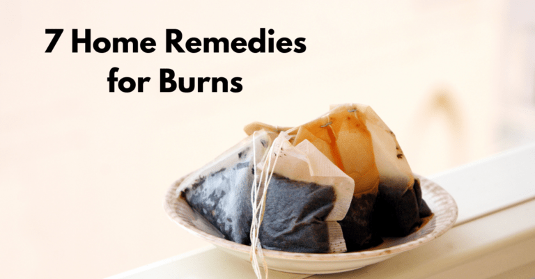 tea bags sitting on a small plate with words that say "7 Home Remedies for Burns"