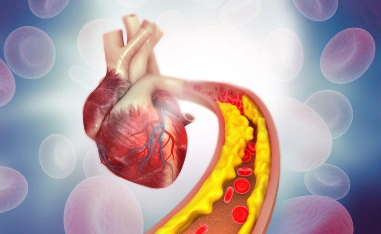 Recent image for Cholesterol Clarity – Nutrition Diva’s Greatest Tips